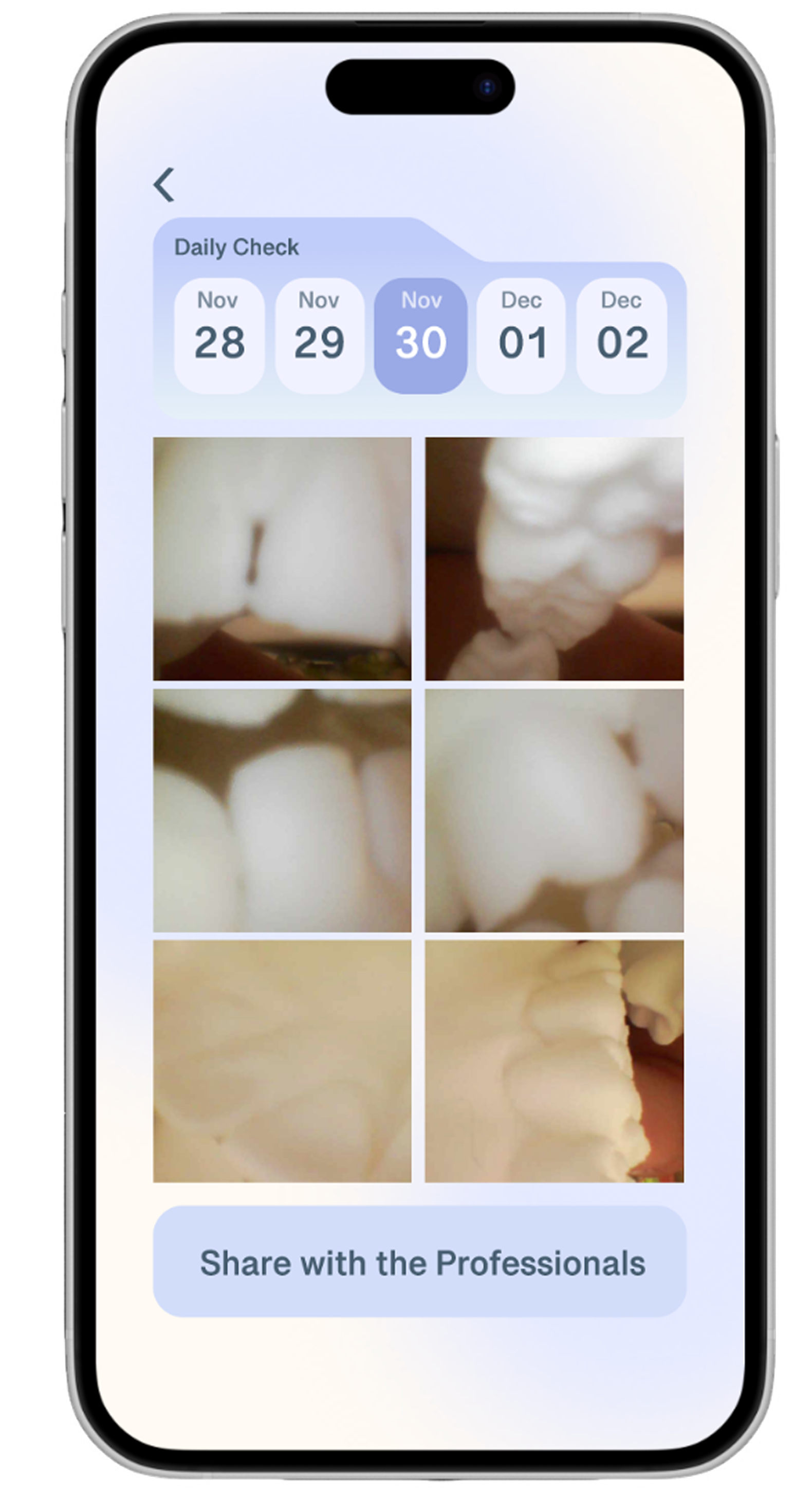 Image Capture